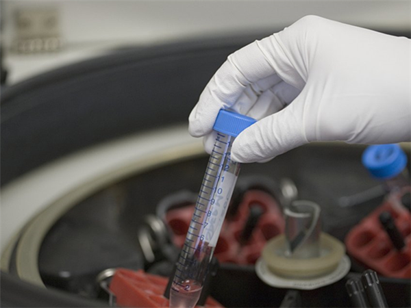 重庆妇幼保健院供精一般不需要等待