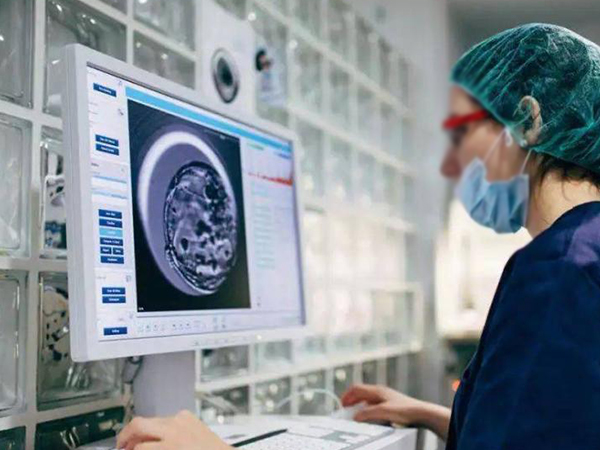 B超监测卵泡发育情况