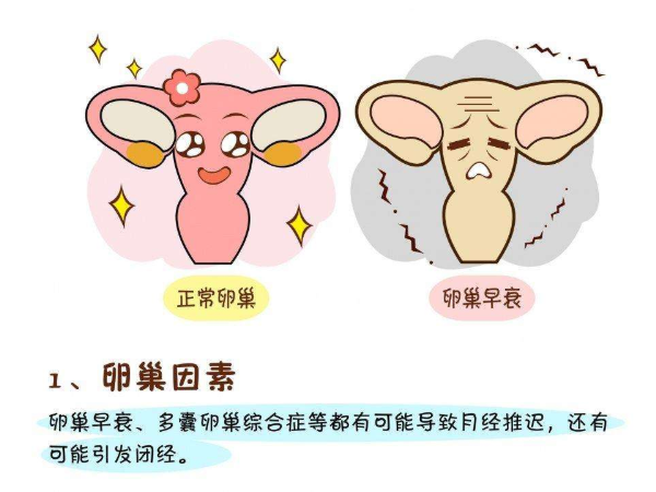 卵巢早衰会引起不孕