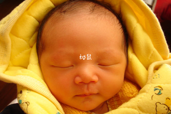 黄疸是逐步扩散的