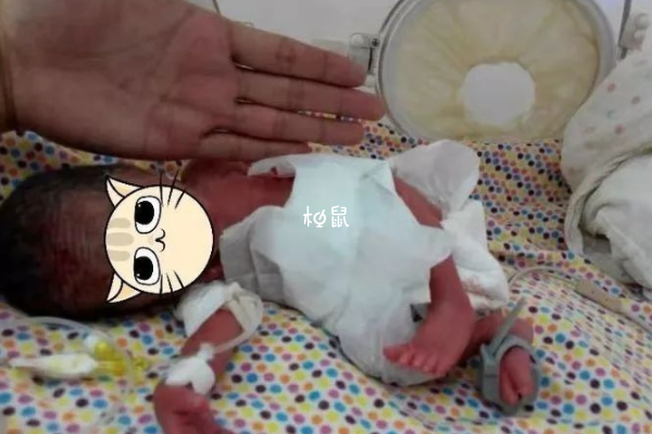 早产儿与足月儿宝宝体重有很大区别