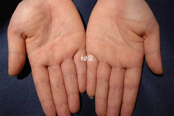 子女线看男女并不准确