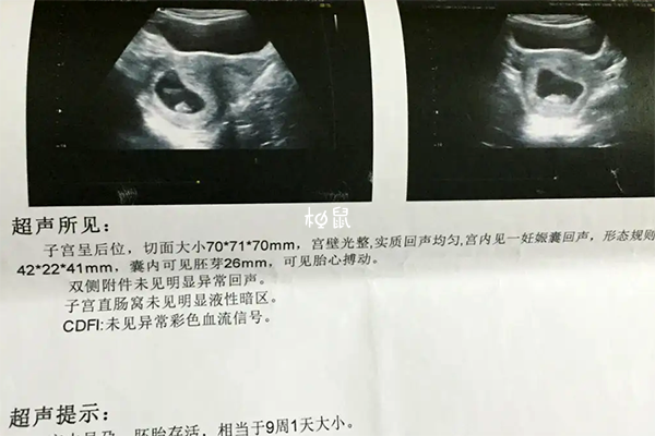 胎芽数据可以看男女