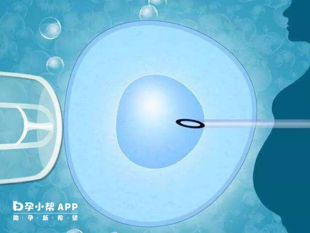北京没有不排队供卵的医院
