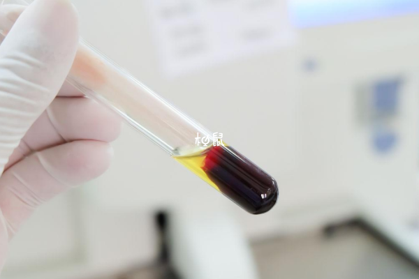 验血出错可能是检查者体内遗留有Y染色体