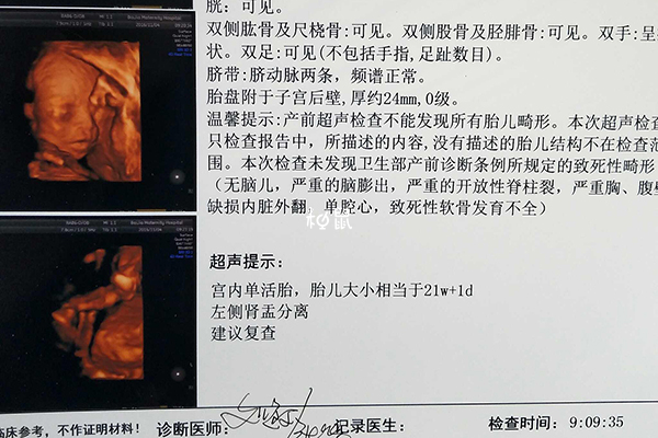 胎儿肾盂分离是怀的男孩