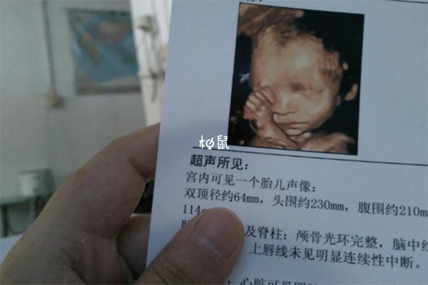 生儿子四维彩超图片