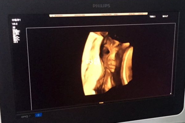 彩超可以通过头部看出胎儿性别