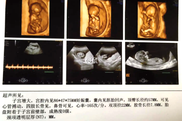 看NT数据能看出男女