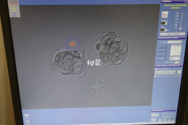 二代试管养囊失败也是正常情况