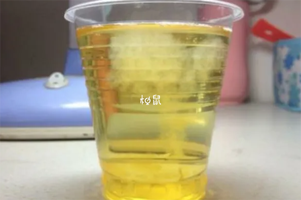 盐水验孕法并不一定准确
