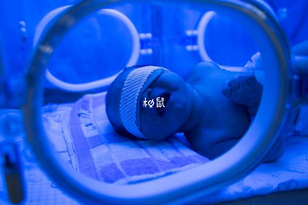 区分黄疸种类的方法