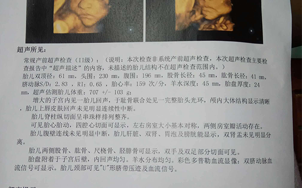 私人诊所通过做B超查男女是真的